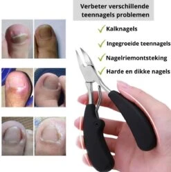 Professionele Kalknagel Schaar - Ingegroeide Teennagel - Nageltang Groot -Nagelschaar Voor Harde Nagels 9 Professionele Kalknagel Schaar - Ingegroeide Teennagel - Nageltang Groot -Nagelschaar Voor Harde Nagels -Nagelbenodigdheden 1196x1200 17