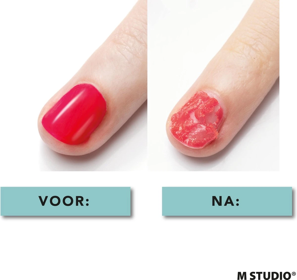 Rosalind Gellak Remover - 15ml - met Nagelvijl en Bokkenpootje Rosalind Gellak Remover - 15ml - Met Nagelvijl En Bokkenpootje -Nagelbenodigdheden